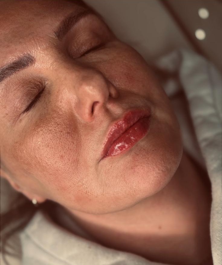 Anti-wrinkle consultation and treatment